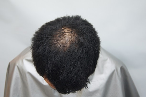 수술전.jpg