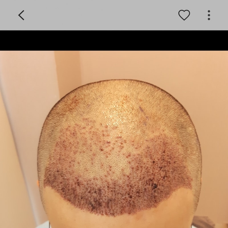 Screenshot_20181117-052410_Gallery.jpg