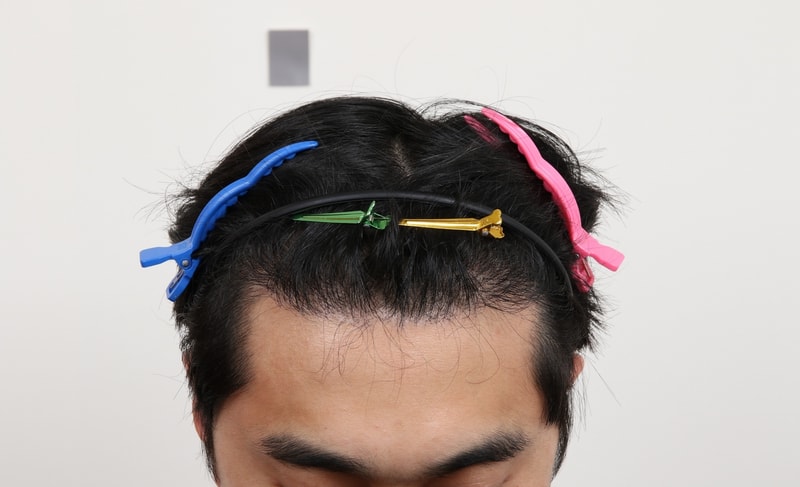 수술 경과 7개월.jpg