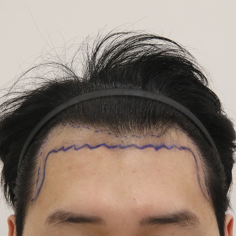 수술 디자인_전병옥님.jpg