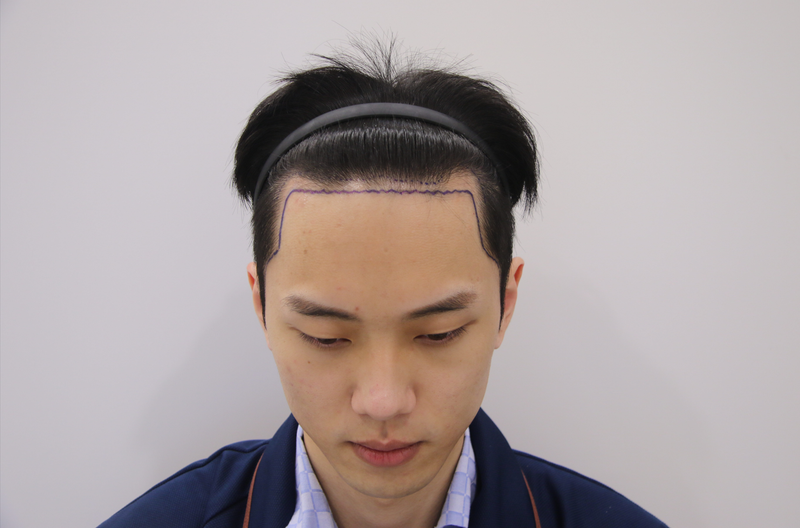 전.png