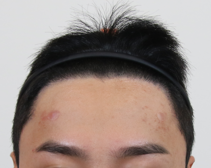수술후2.png