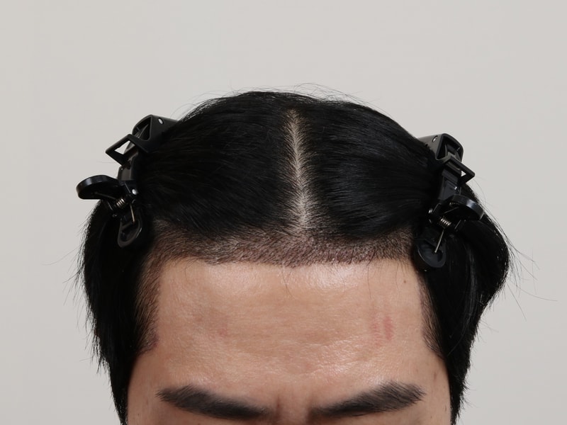3.JPG