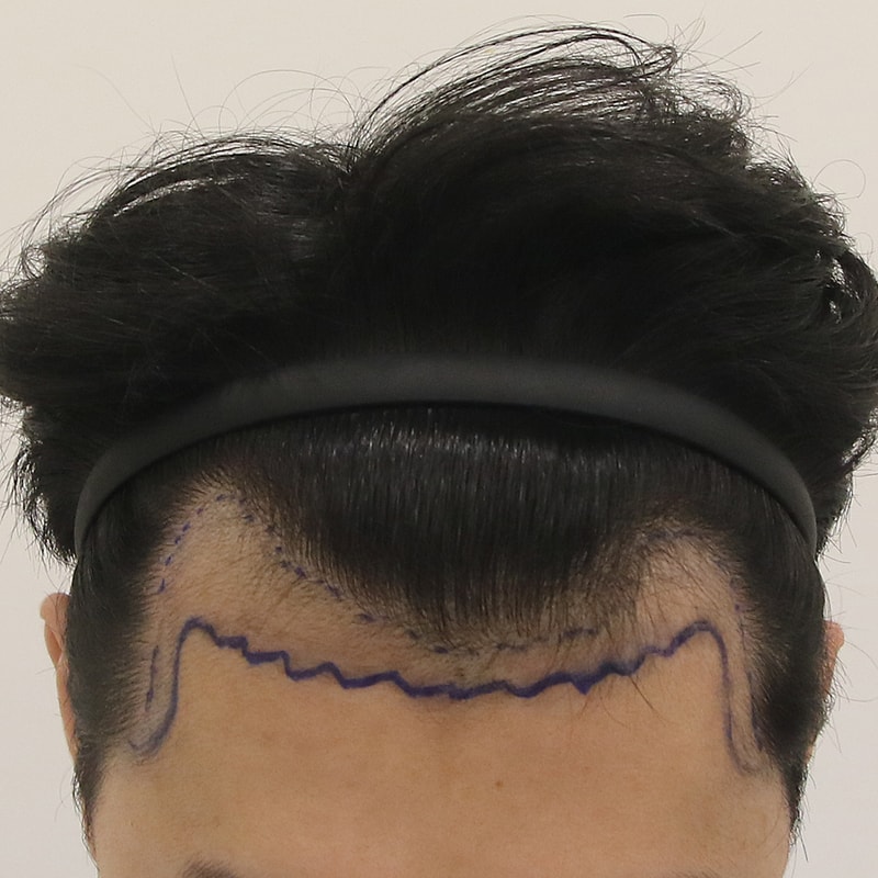 수술 디자인2_전병옥님.jpg