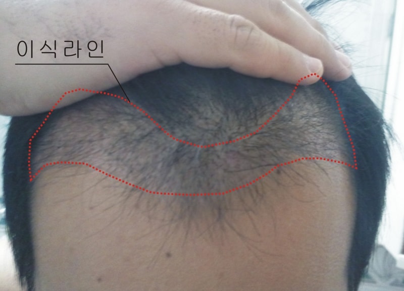 2달.jpg