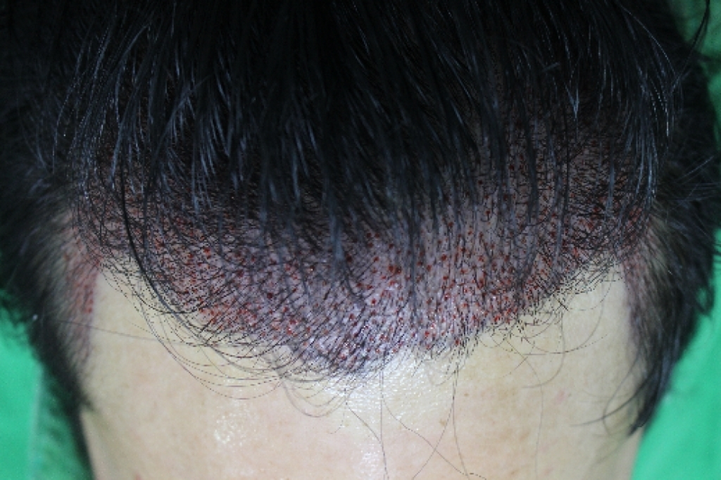 수술중1.png