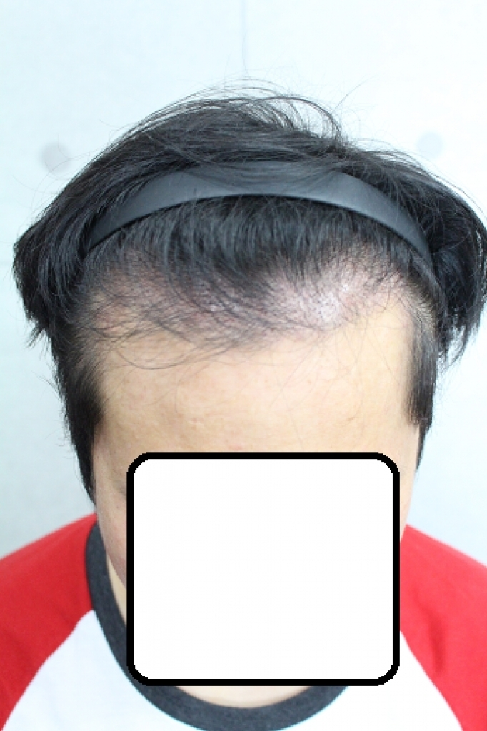 수술전1.png