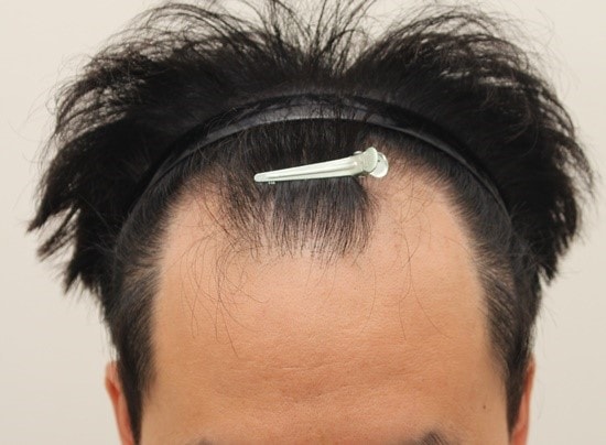 수술전.jpg