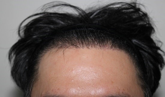 새로나는 머리카락 꼬불거리나요?