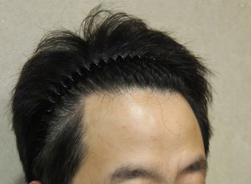 선택1.jpg
