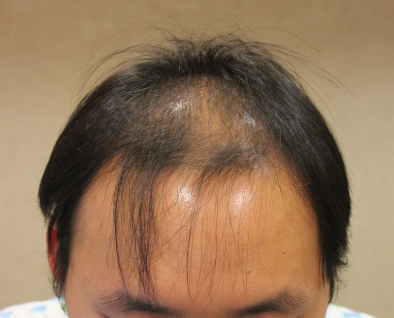 수술전1.jpg