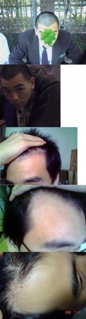 20%BB%EC_dltpgks23832.jpg