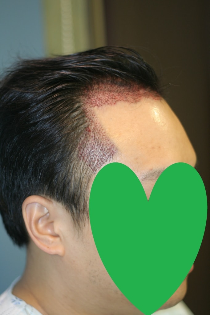 우애프터.jpg