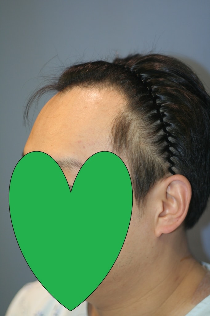 좌비포.jpg