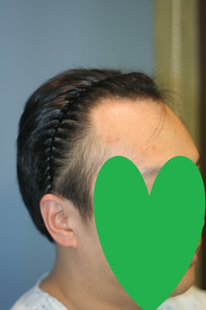 우비포.jpg