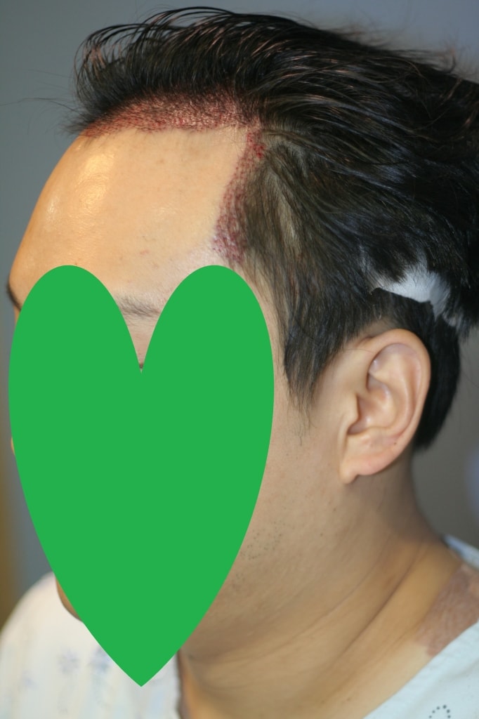 좌애프터.jpg