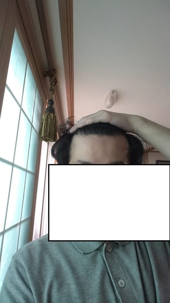 후2.jpg