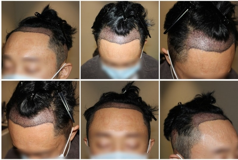 샴푸 후.jpg