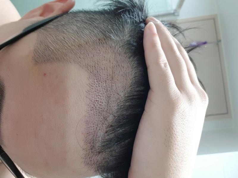 Day 4 of non-intercept (after fingerprint shaving)