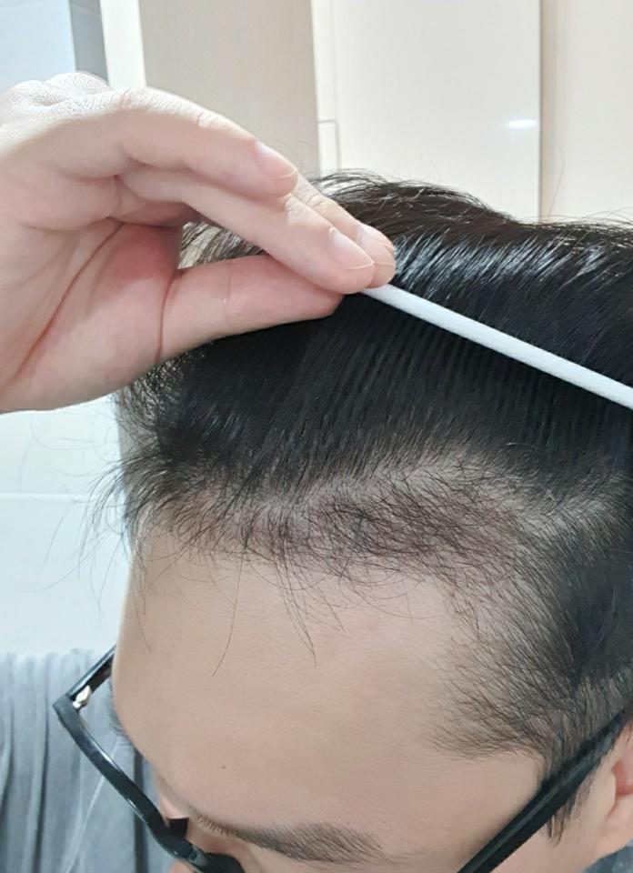 Day 108 of non-cut 2700 Mo