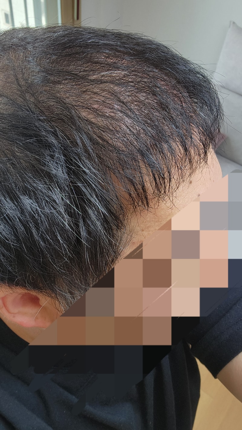후3.jpg
