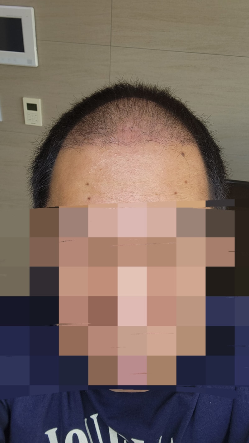 수술후1.jpg