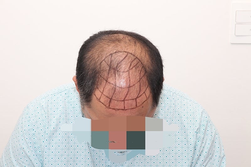 수술전2.jpeg
