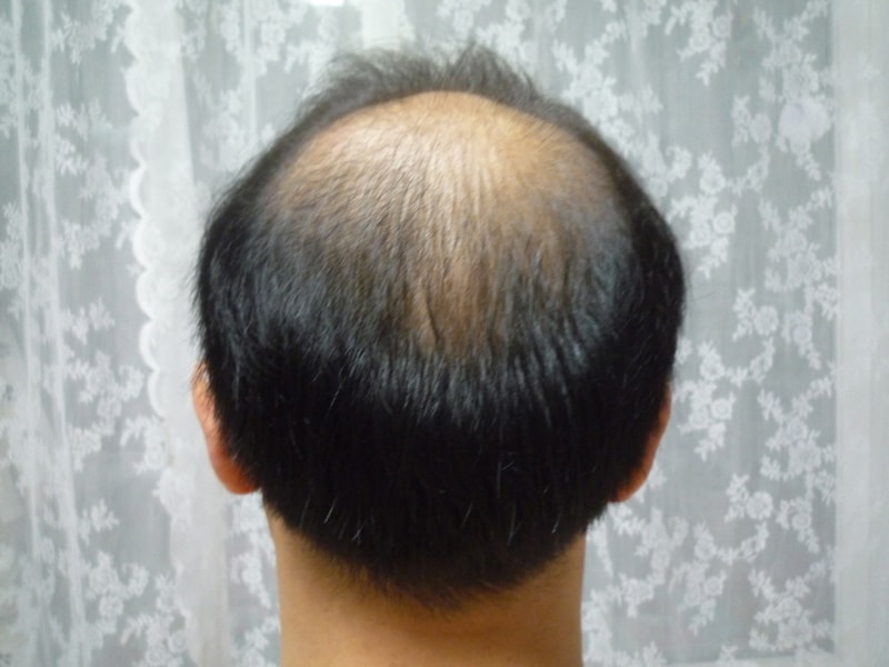 수술전 2.jpg