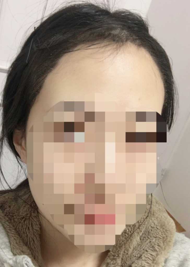 3400모 절개 이주차 왔어요!