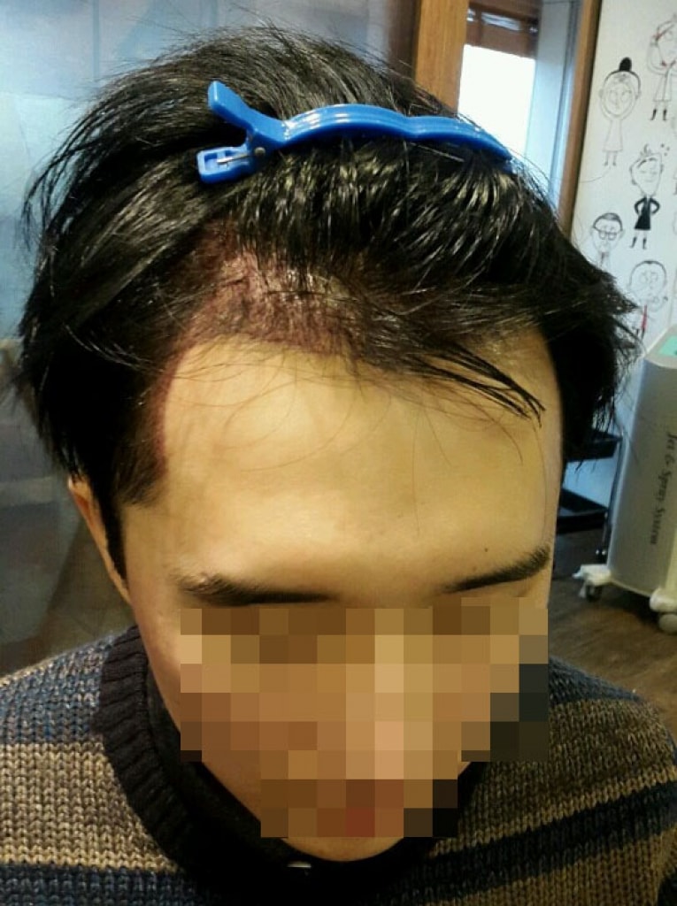 이틀3.jpg