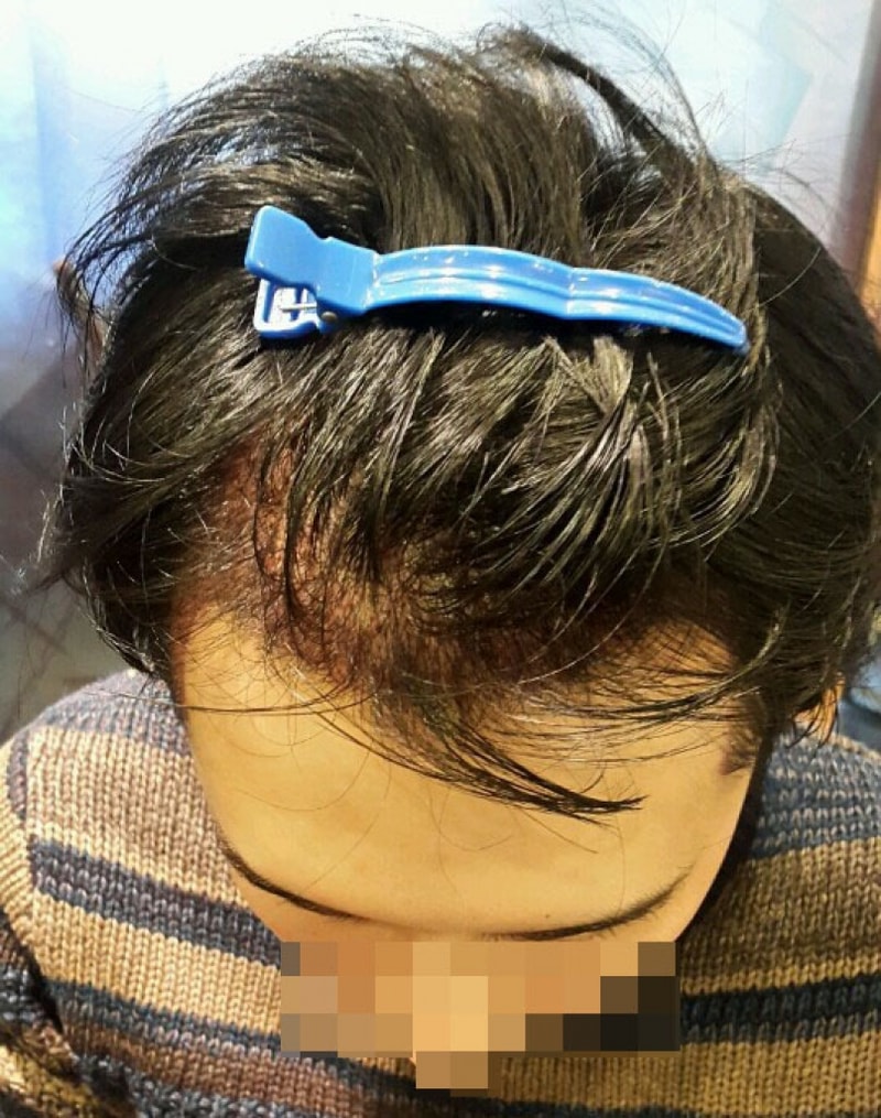 이틀4.jpg
