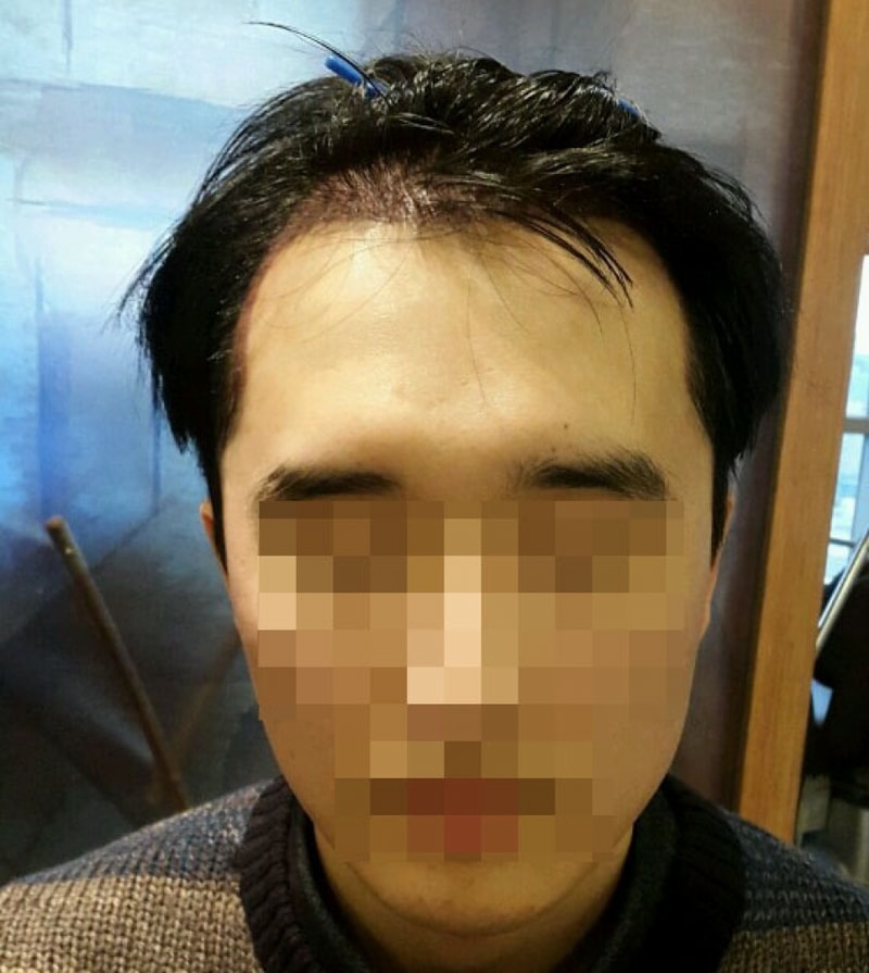 이틀1.jpg