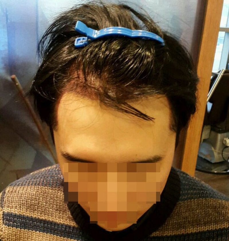 이틀2.jpg