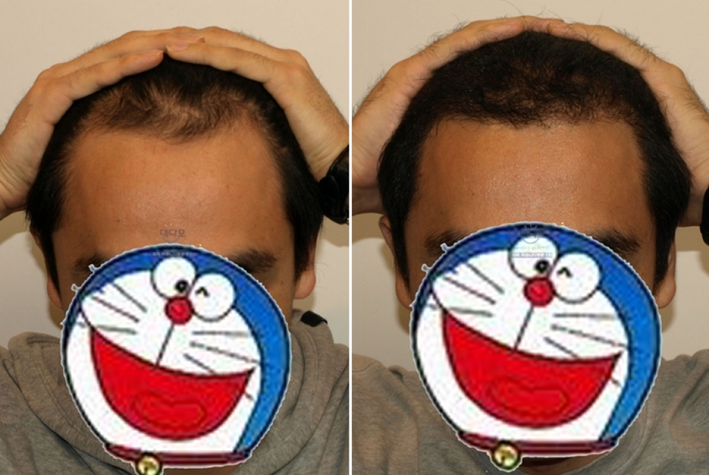 2.PNG