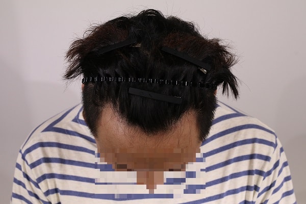 수술전2.jpg