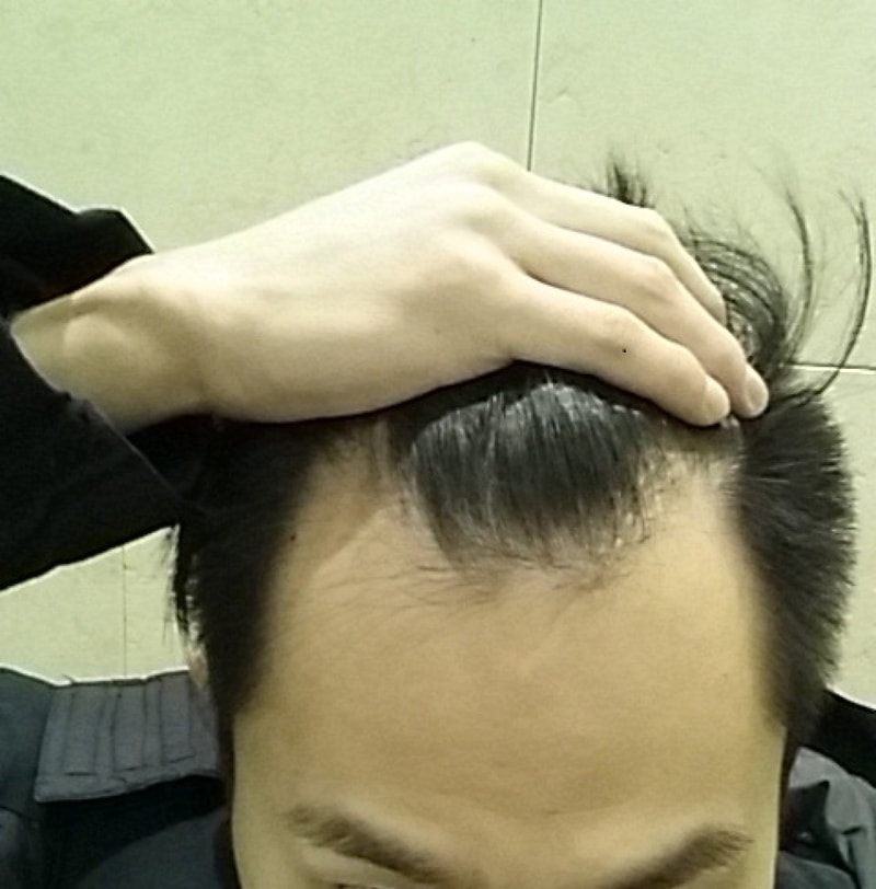 20141117_093207.jpg