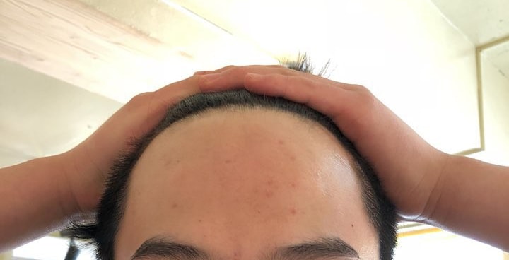 克服了黑历史黑暗期，正在暴风成长中。