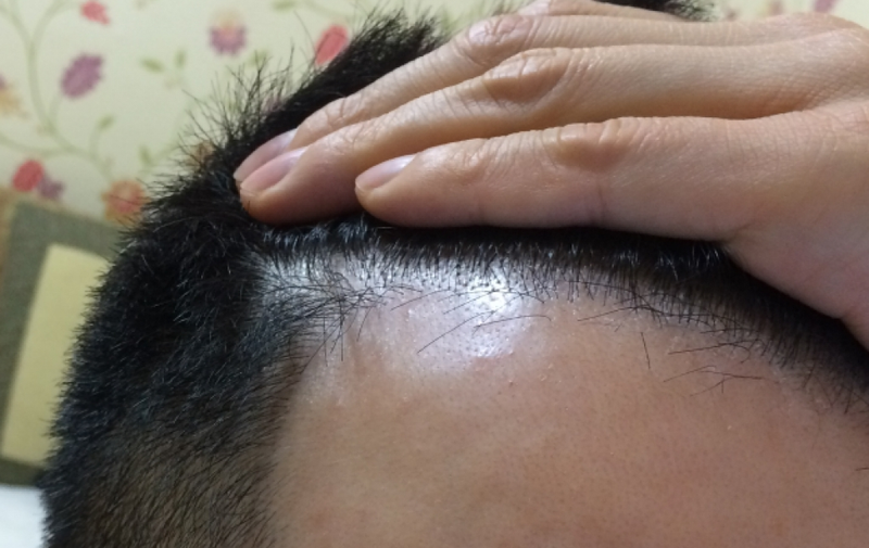 20150324_200526.png