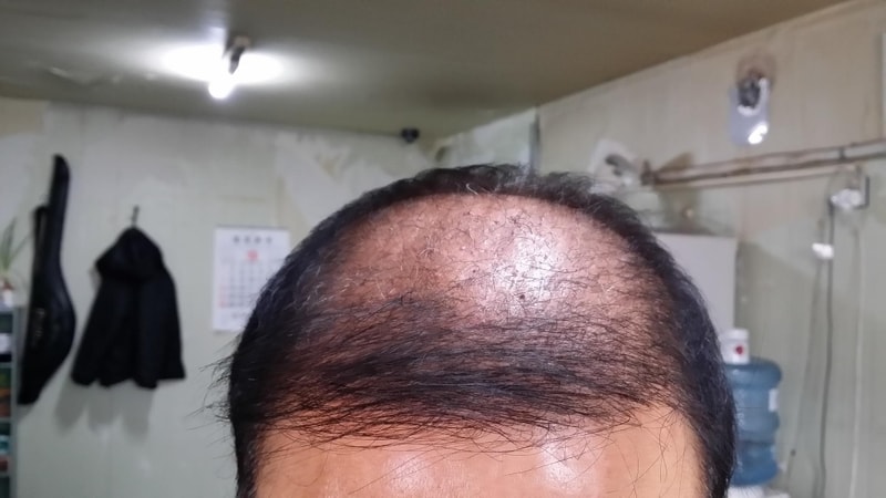 수후두달2.jpg