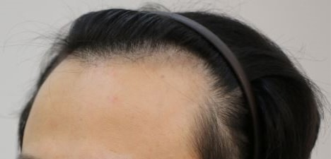 [크기변환]수술전2.JPG