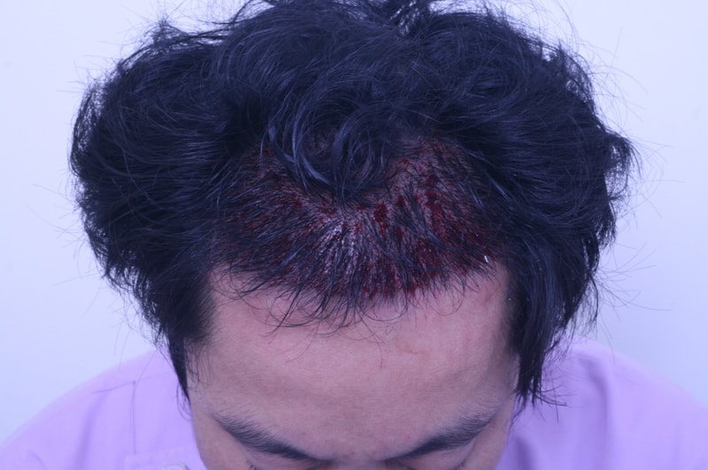 크기변환_수술후2.jpg