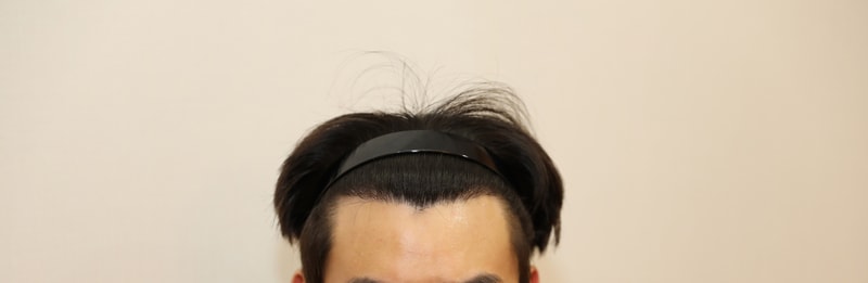 후4.jpg