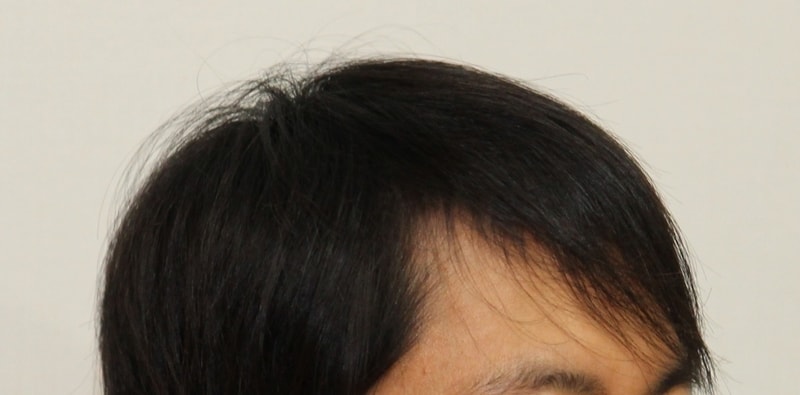 IMG_9864.JPG