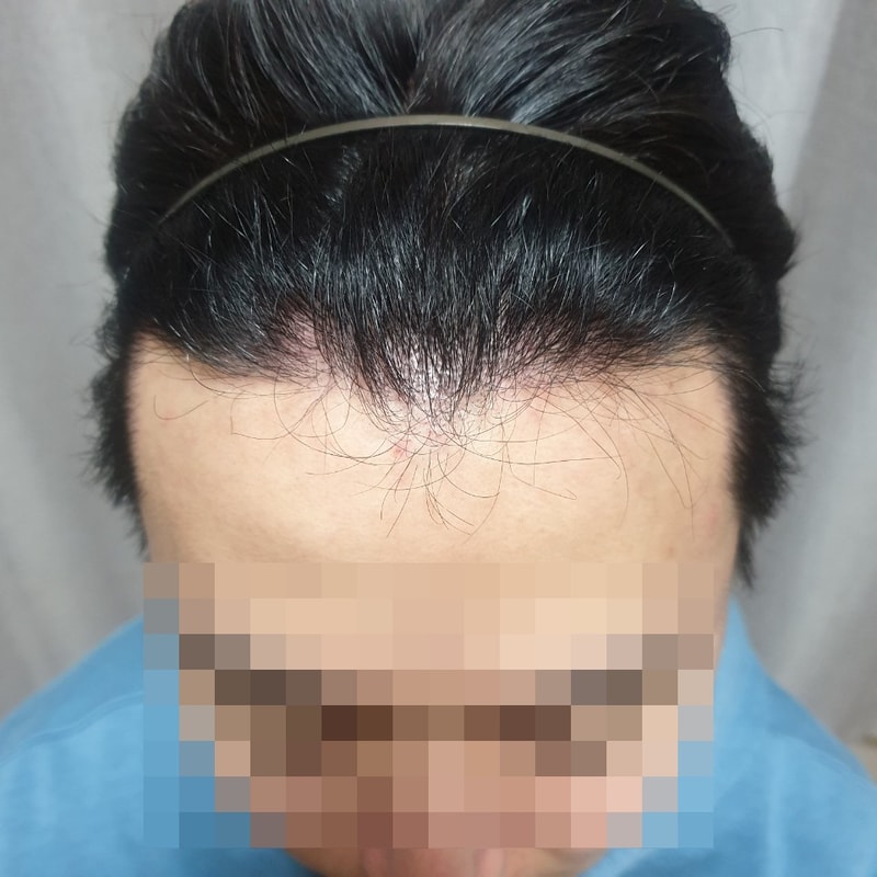 모자이크(2).jpg