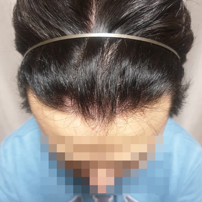 모자이크(1).jpg