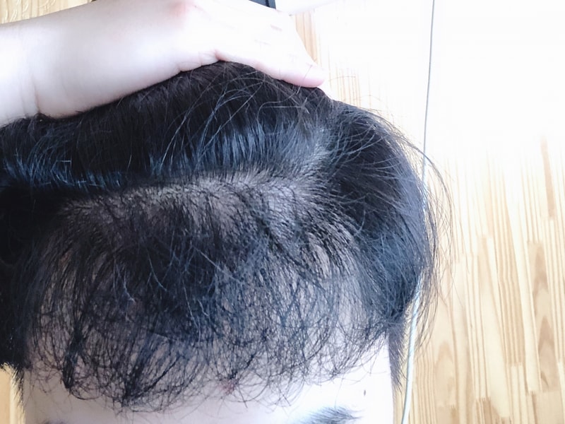 최근.jpg