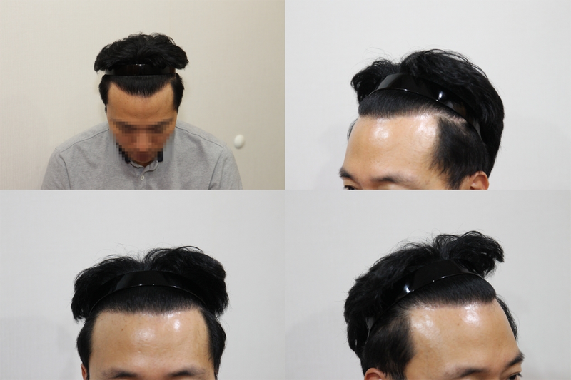 후.png