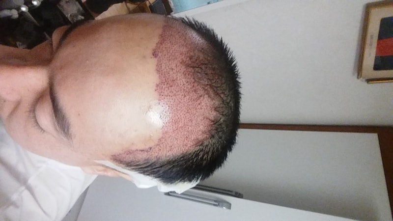 20170303_090202.jpg