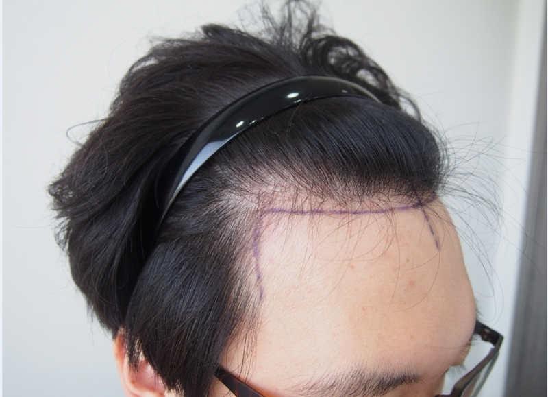 우측디자인.PNG