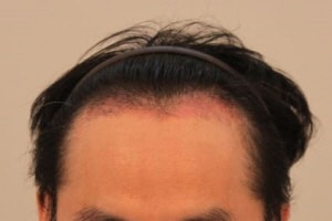 [크기변환]1개월.JPG